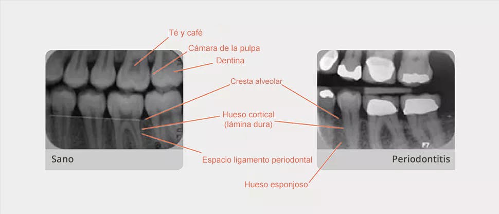 Radiografía comentada