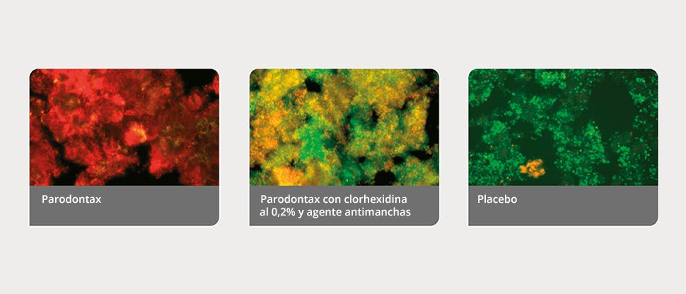 Biopelículas de placa definidas por un programa de análisis de imágenes