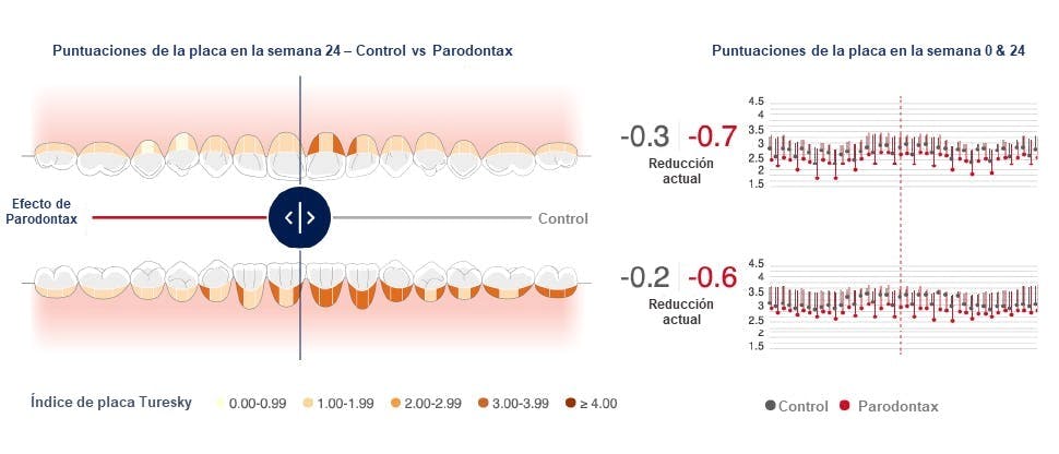 Imagen de la herramienta del mapa bucal que muestra la reducción de la placa tras el uso del dentífrico paradontax de bicarbonato sódico.