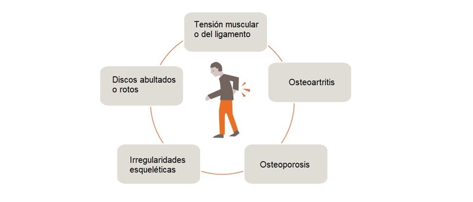 Gráfico que muestra las posibles causas del dolor de espalda