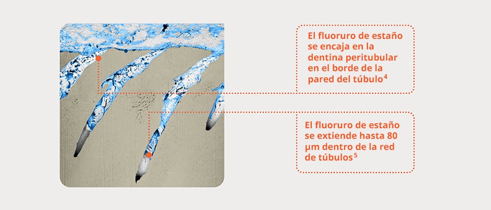 Imagen FIB-SEM representativa de los túbulos de la dentina