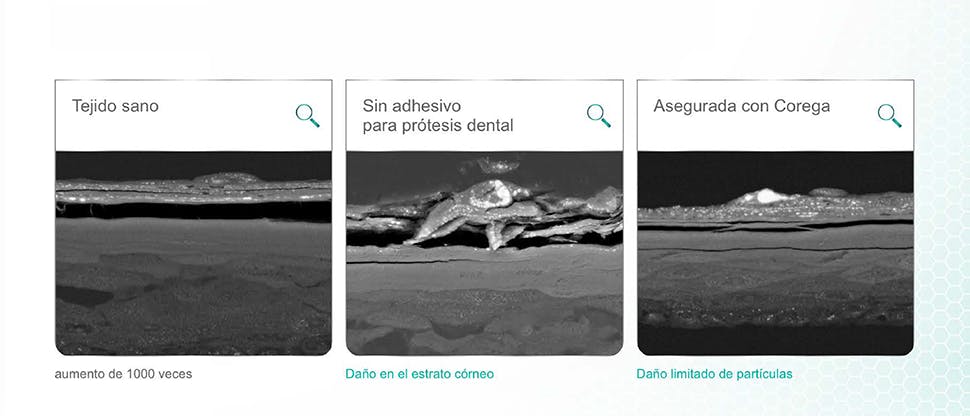 Tejido oral tras 12 horas de agitación con semillas de amapola y discos acrílicos en pruebas de laboratorio