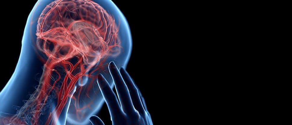 Dolor de cabeza
