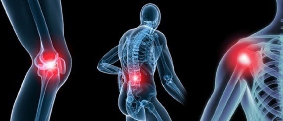 El dolor en osteoartritis (OA)