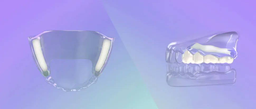 Modo de acción del adhesivo para prótesis dentales