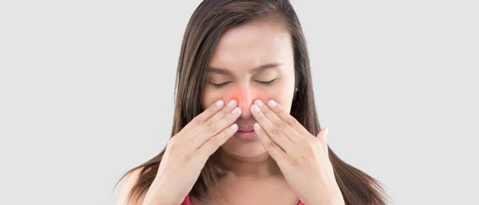 Imagen irritación de congestión nasal