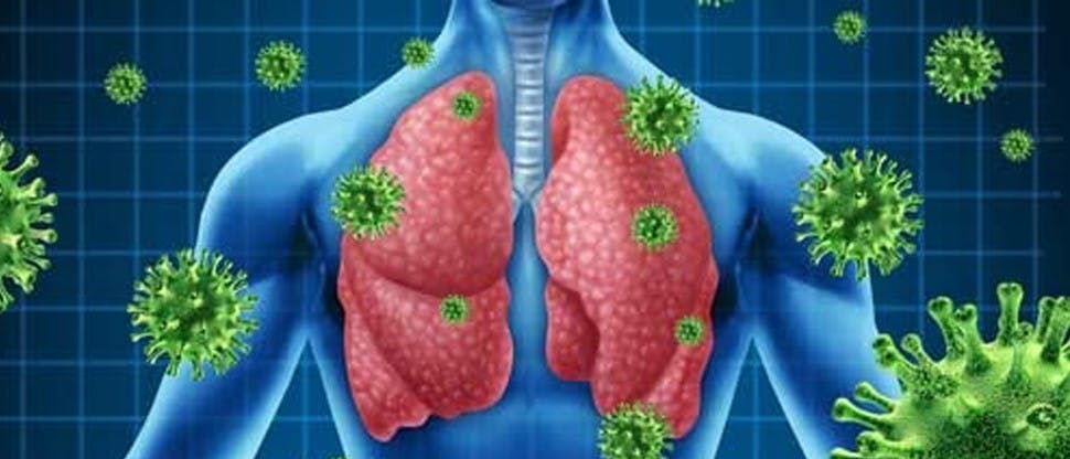Imagen pulmones infección IRAS