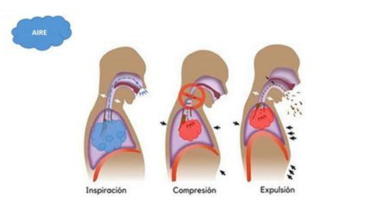 Imagen hiperreactividad del reflejo de la tos