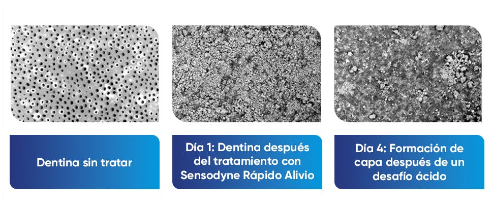 Imágenes SEM de la dentina