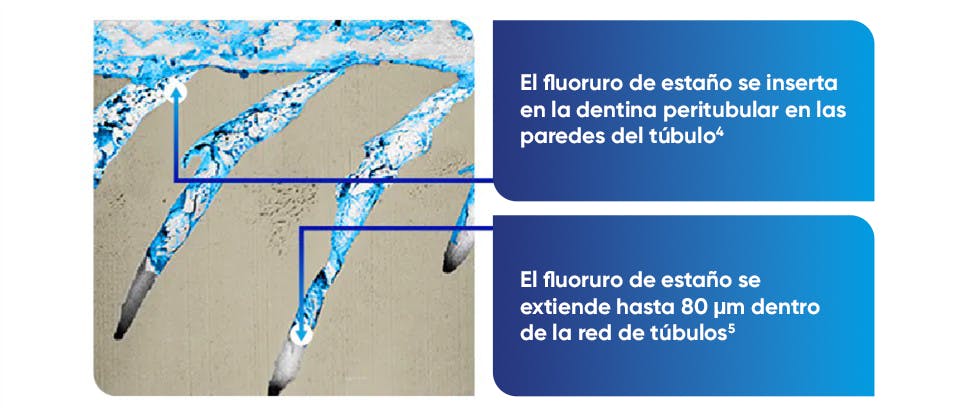 Imagen FIB-SEM representativa de los túbulos dentinarios