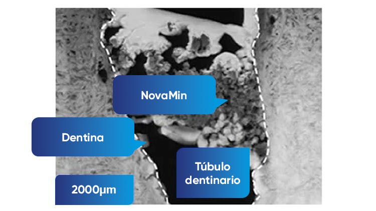 Imagen TEM de la dentina a 2000nm