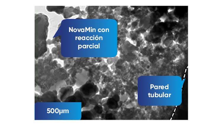 Imagen TEM de la dentina a 500nm