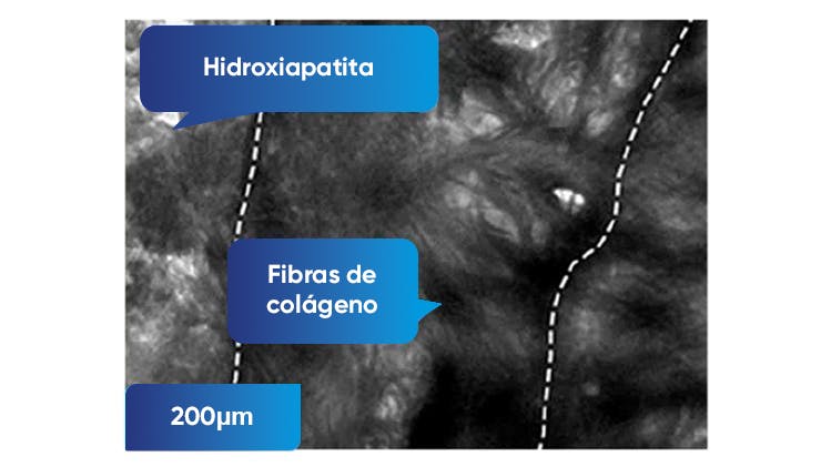 Imagen TEM de la dentina a 200nm