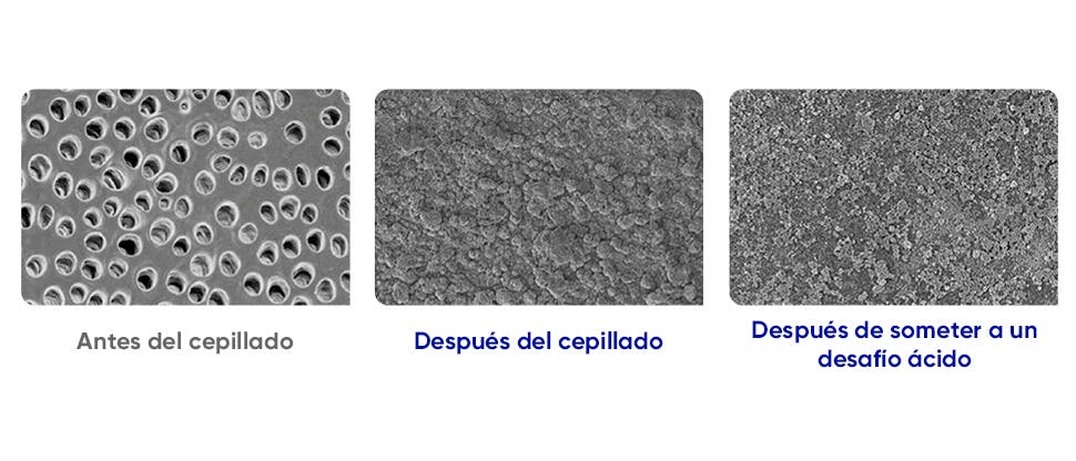 Imágenes de microscopio electrónico de barrido (SEM) de la superficie de la dentina