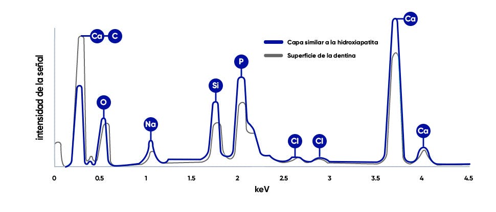 Gráficos de rayos X del gráfico de la dentina