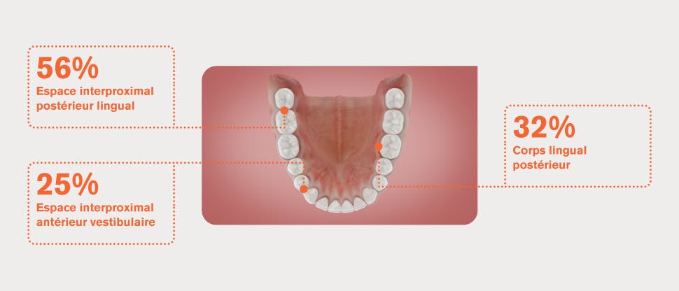 Dents d'images