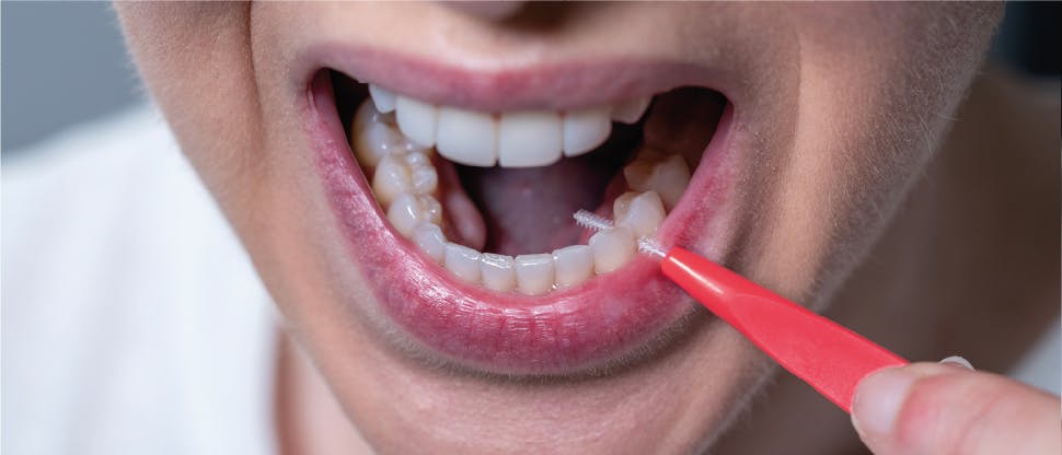 La personne se brosse les dents avec la brosse interdentaire