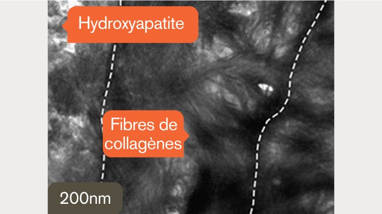 Image MET de la dentine à 200 nm