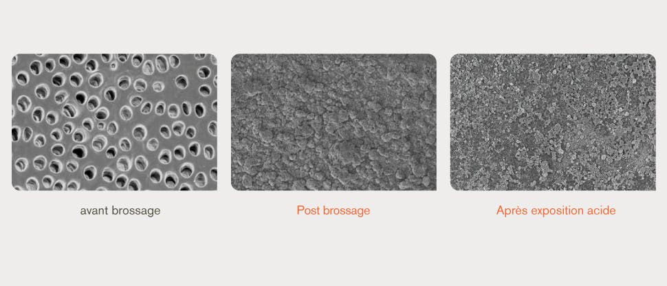 Images SEM (microscope électronique à balayage) de la surface de la dentine