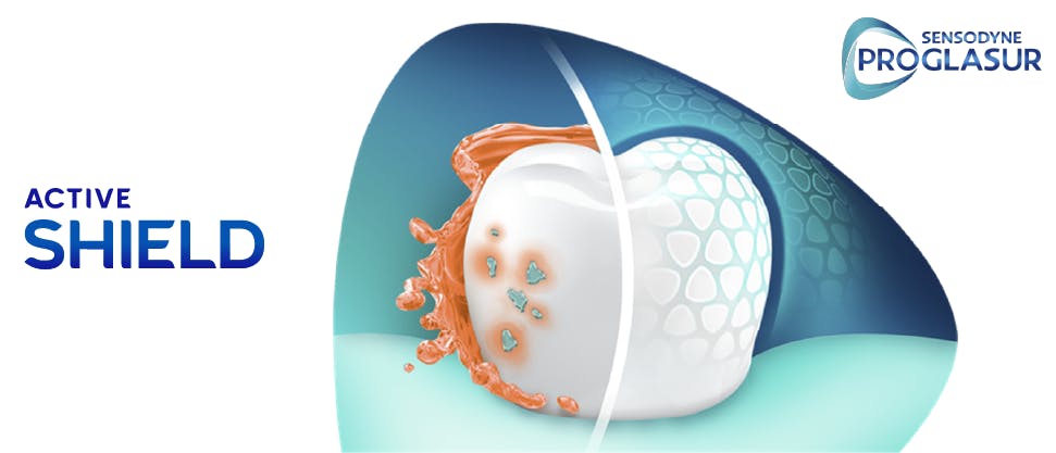 Graphique illustrant l’action protectrice du dentifrice au fluorure Pronamel Bouclier Actif pour l’Émail sur une dent 