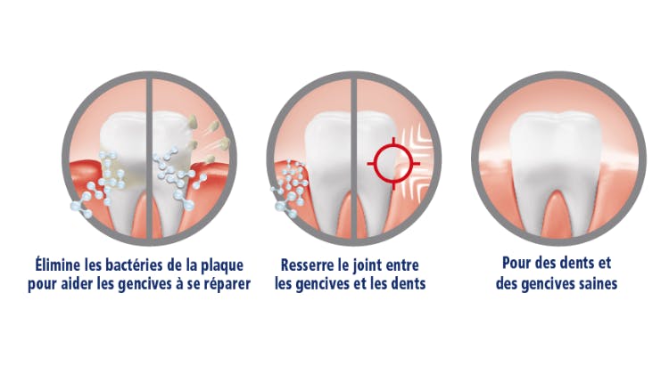 Graphique montrant comment Periodontax Active Repair élimine les bactéries de la plaque dentaire, resserre le joint gingival et contribue à la santé des dents et des gencives