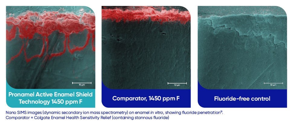 Images montrant la pénétration du fluorure dans l’émail dentaire par le dentifrice Pronamel Bouclier Actif pour l’Émail, comparée à une moindre pénétration par un dentifrice comparateur contenant la même quantité de fluorure 
