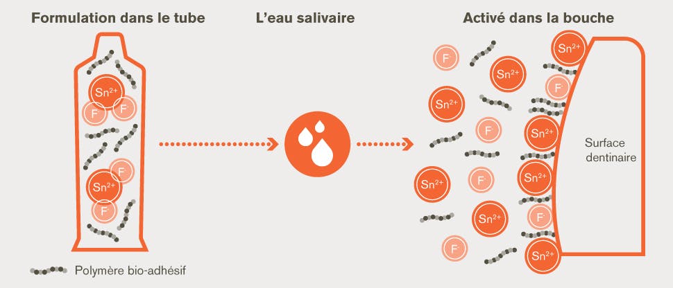 Exemple d'action du fluorure d'étain dans la cavité buccale/la bouche