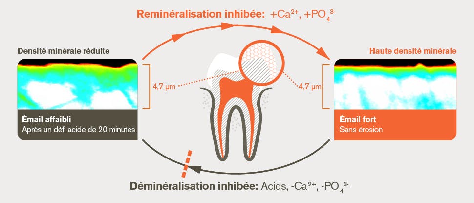 Déminéralisation et reminéralisation