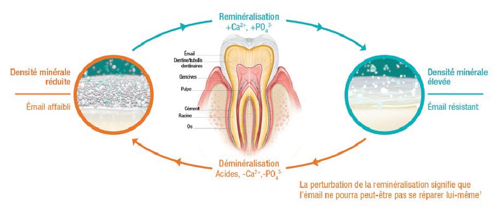 La formule répare activement l’émail affaibli par les acides