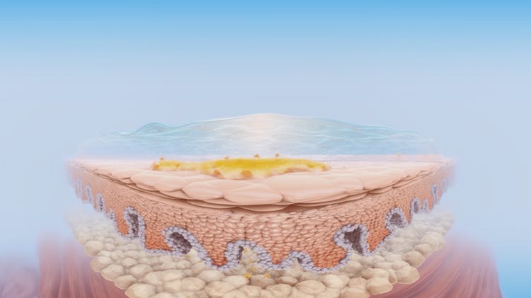 Comment le diclofénac réduit l’inflammation