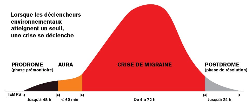 Les quatre phases de la migraine