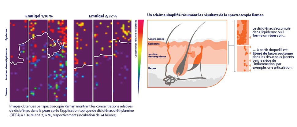 Voltaren forme un réservoir dans l’épiderme pour permettre une libération prolongée de diclofénac