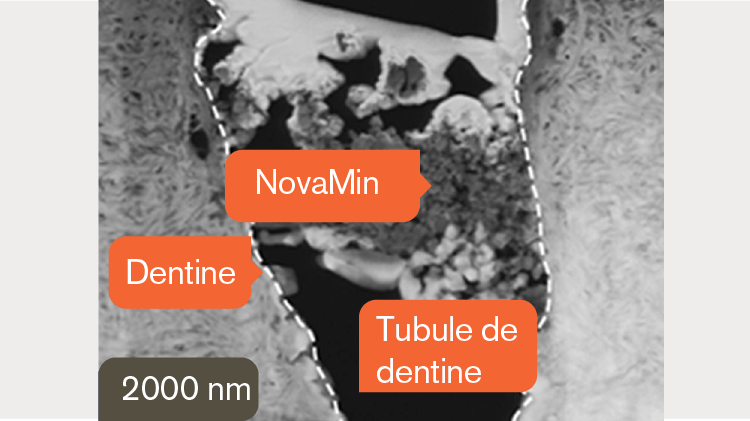 Image TEM de la dentine à 2000 nm
