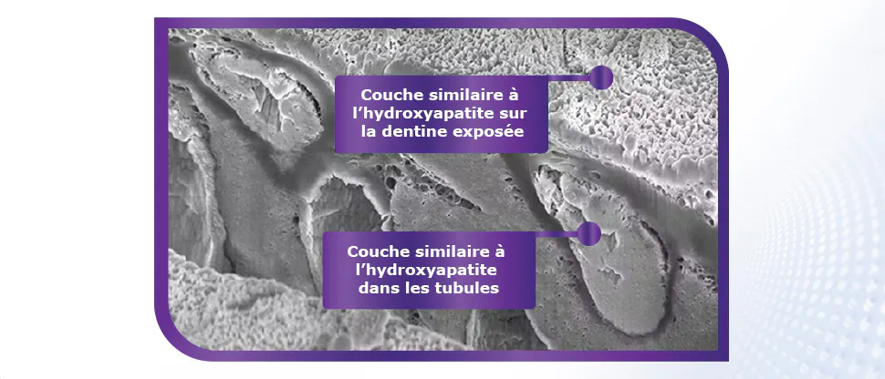 Image de MEB de la couche similaire à l’hydroxyapatite sur la dentine exposée