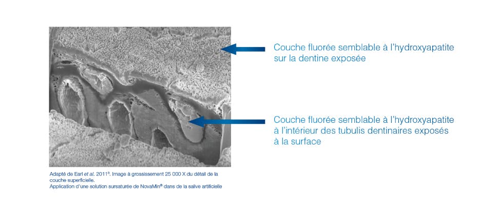Print in vitro Coupe d'image en coupe X