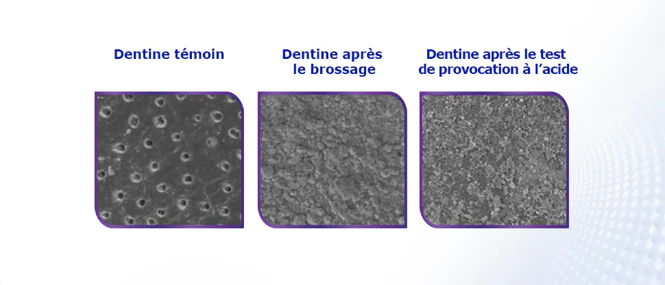 Images au microscope électronique à balayage (MEB) de la surface de la dentine