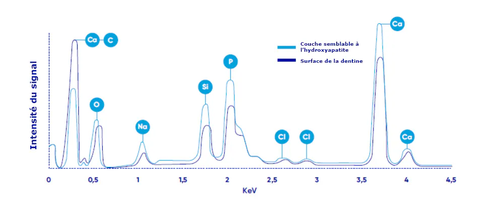 Tracé des rayonnements X de la dentine