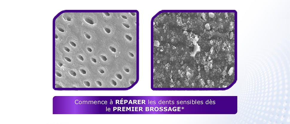 Image de tubules dentinaires au microscope
