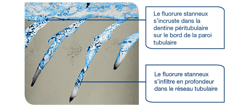 Image représentative FIB-SEM de tubules de dentine