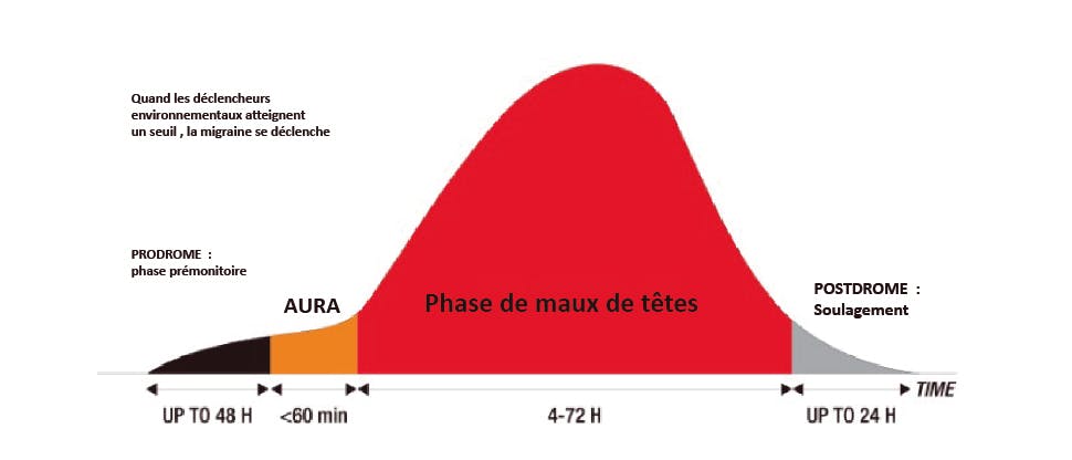 Les quatre phases de la migraine
