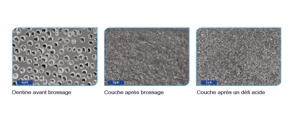 Images au microscope électronique à balayage (MEB) de la surface de la dentine