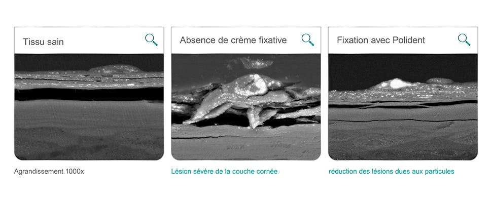 Tissus buccaux après 12 heures d’agitation avec des graines de pavot et des disques acryliques dans des tests de laboratoire