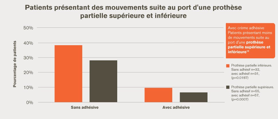 Mouvement dans les prothèses dentaires partielles inférieures et supérieures