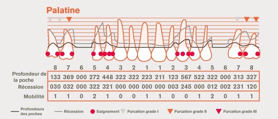 Charting parodontal détaillé