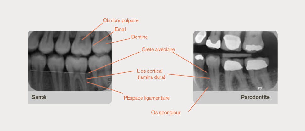 Radiographie annotée