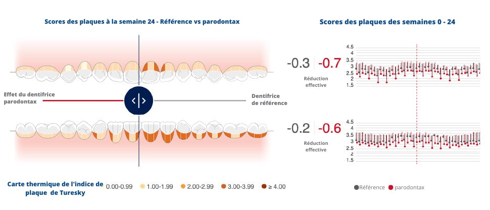 de l'outil mouthmap montrant la réduction 