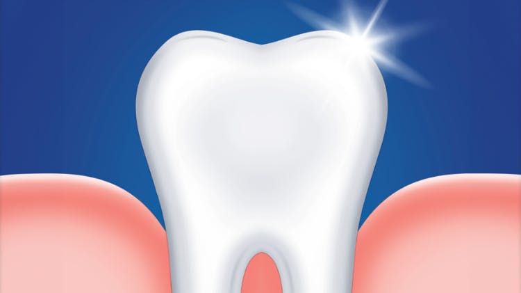 Tout ce qu’il faut savoir sur les caries.