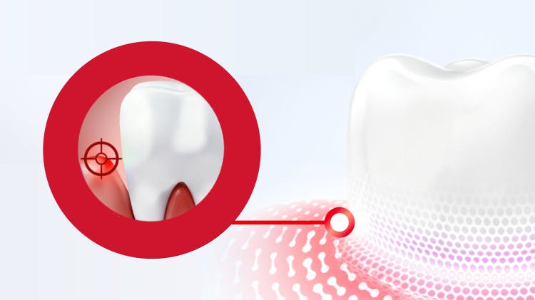 Tout ce qu’il faut savoir sur la parodontite.