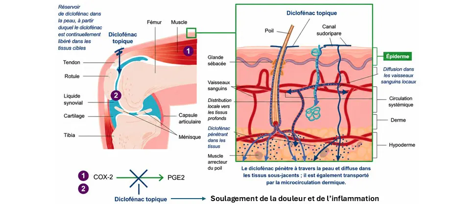Pénétration du diclofénac topique à travers la peau et perméation à travers les couches plus profondes jusqu'à l'articulation enflammée3.