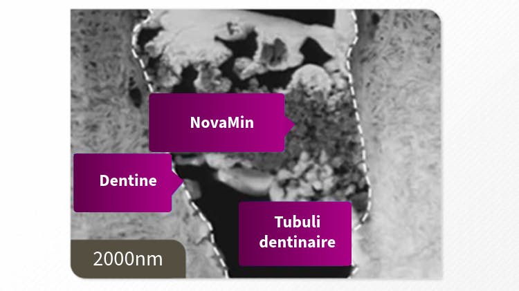 Cliché MET de la dentine à 2 000 nm